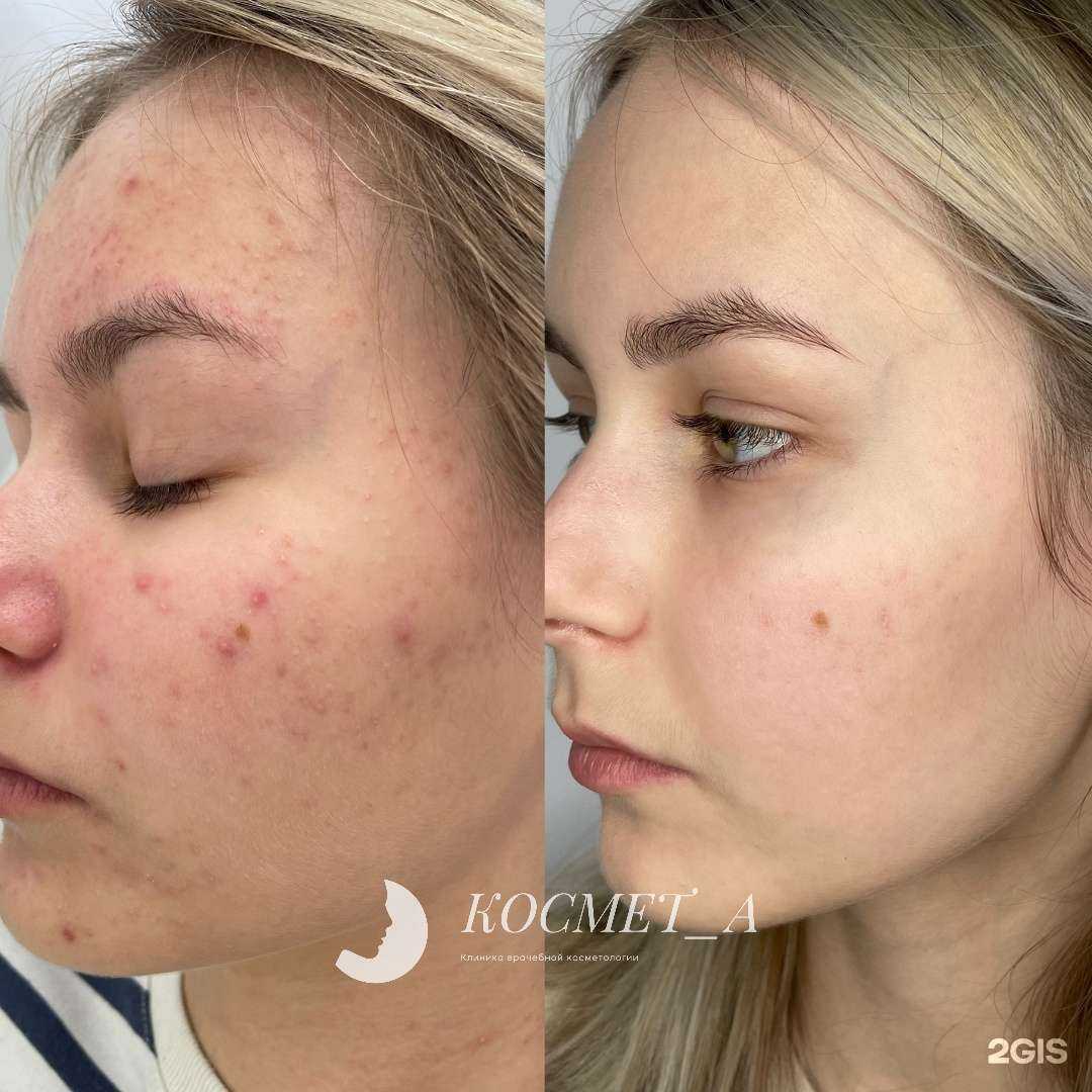 Отзывы на компанию Космет_А в Набережных Челнах c фото