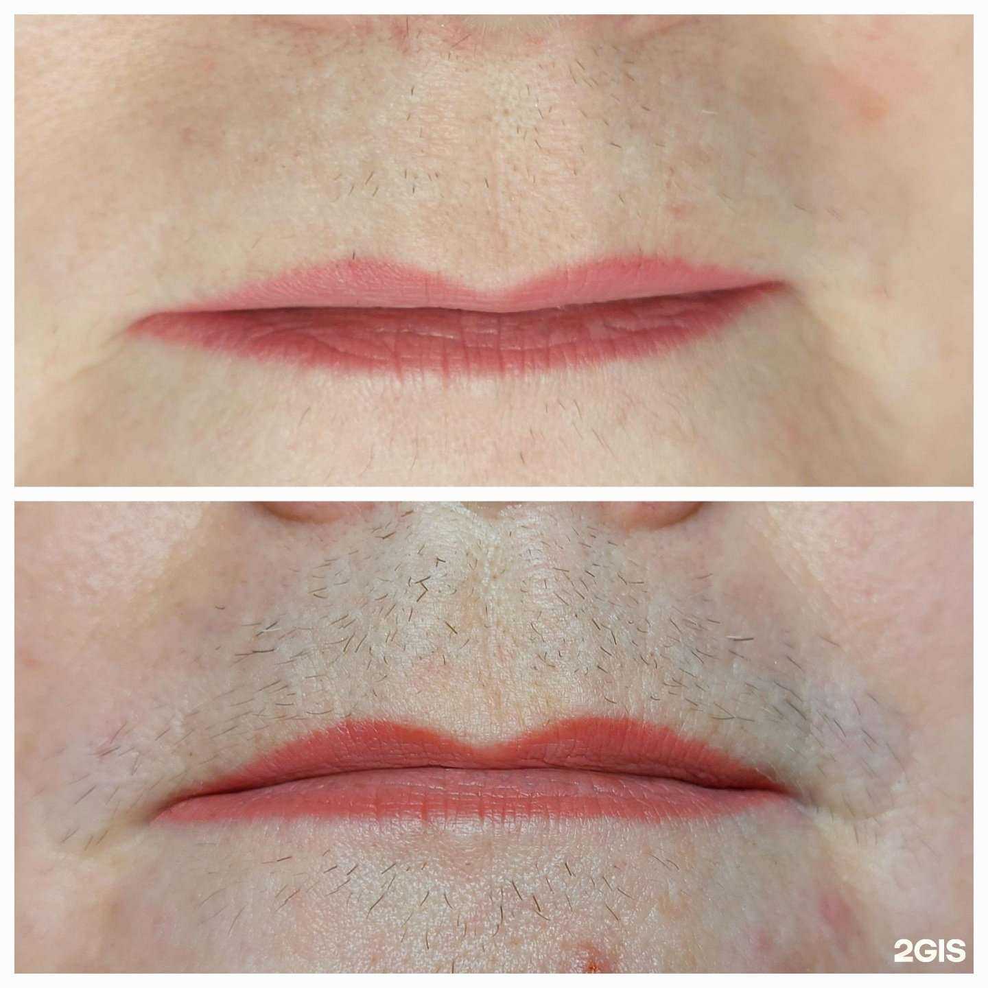 Отзывы на компанию Electroepil в Ставрополе c фото