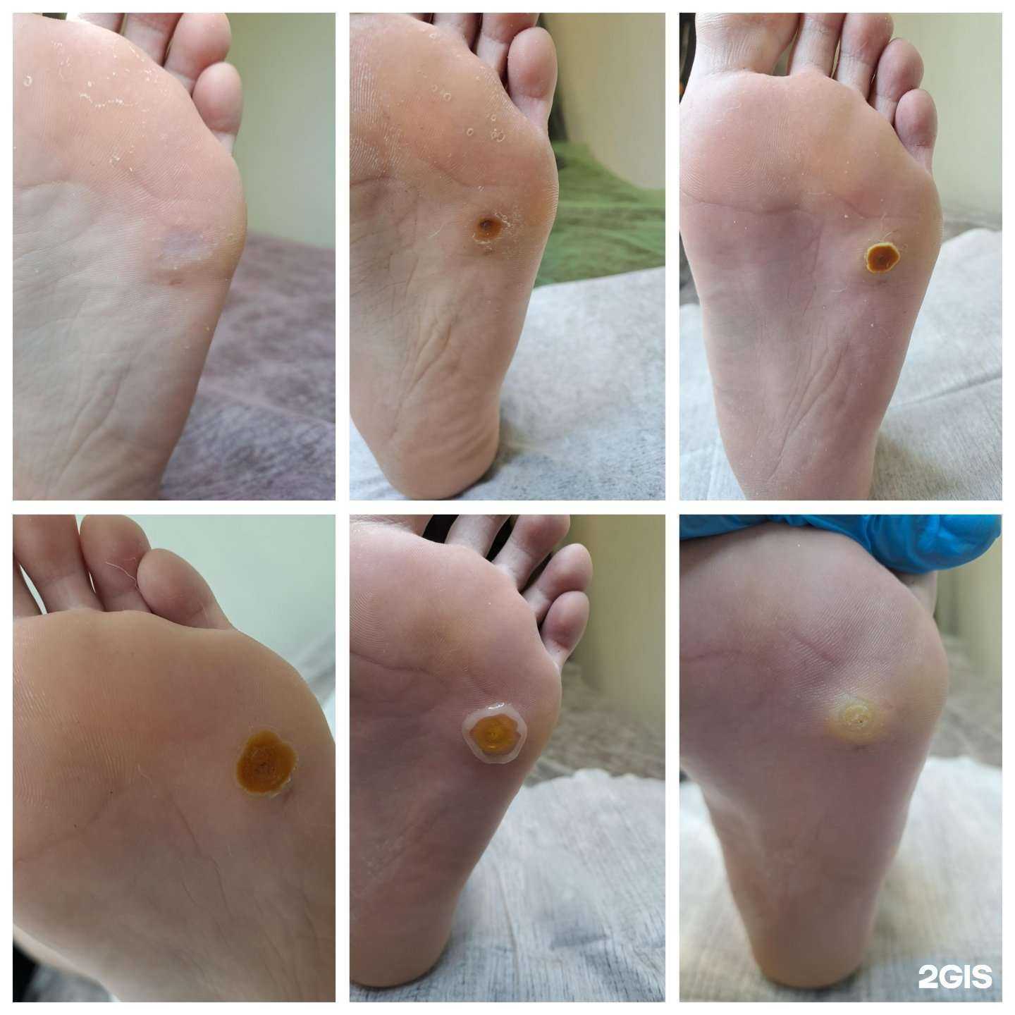 Отзывы на компанию Кабинет подолога в Новокузнецке c фото