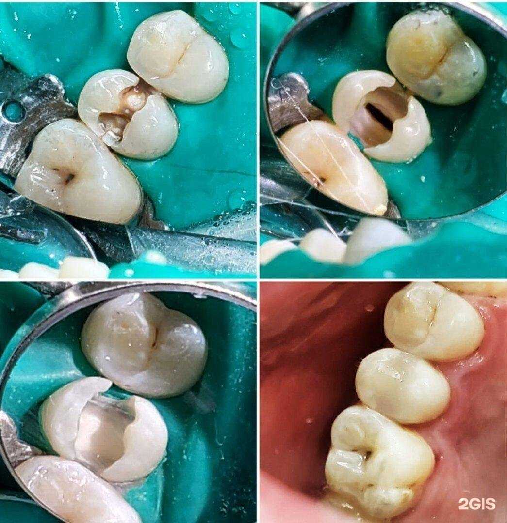 Отзывы на компанию Центр Дентальной Имплантации в Воронеже c фото