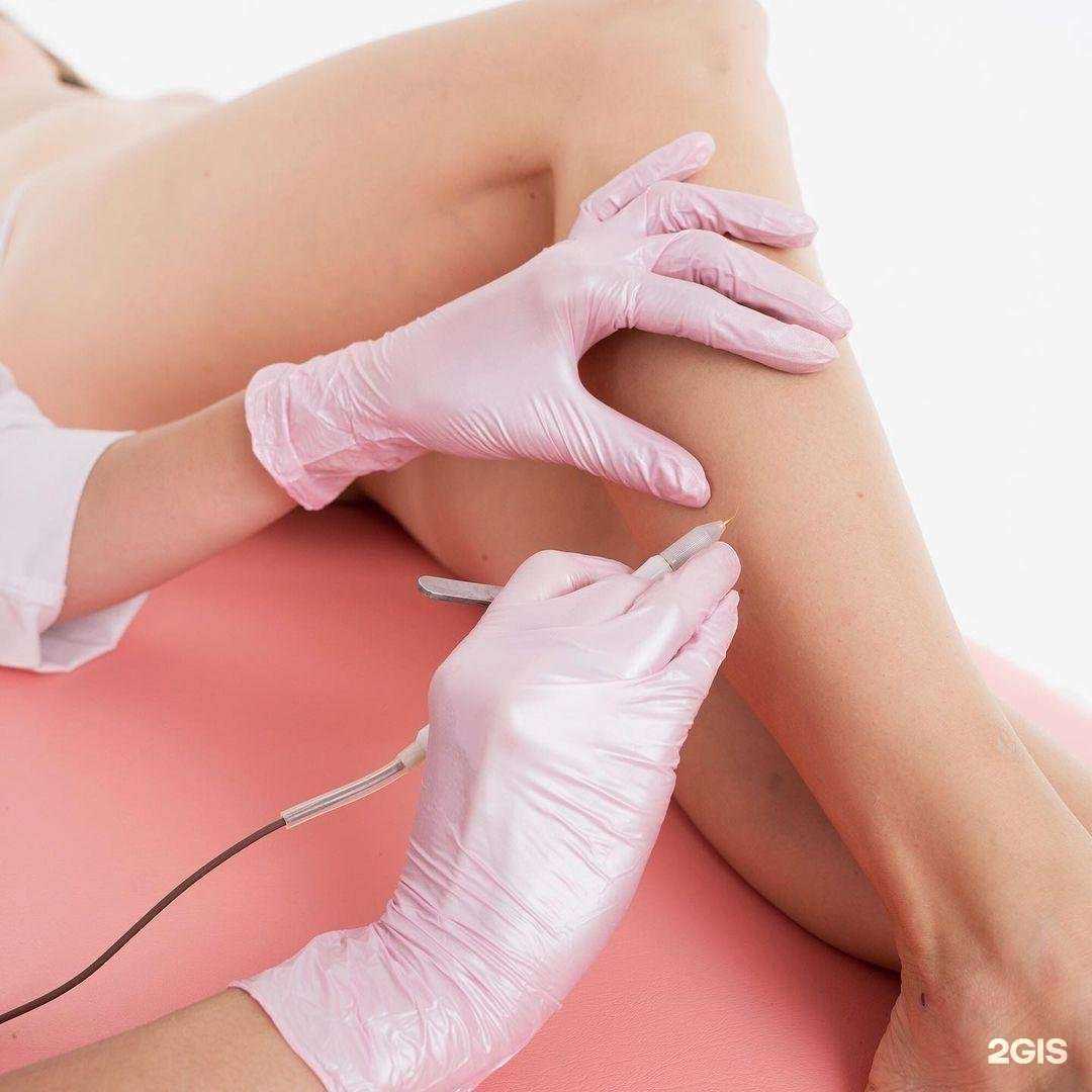 Отзывы на компанию Epil72 в Тюмени c фото