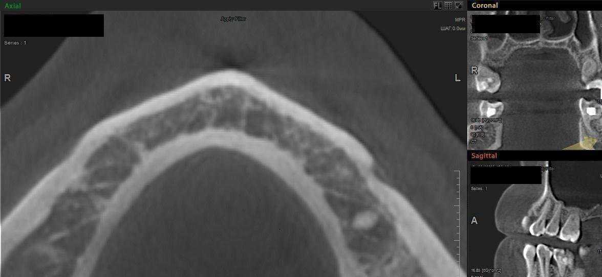 Отзывы на компанию Дента студия в Чебоксарах c фото
