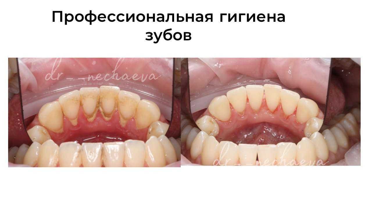 Отзывы на компанию Сити дент в г. Тюмень c фото