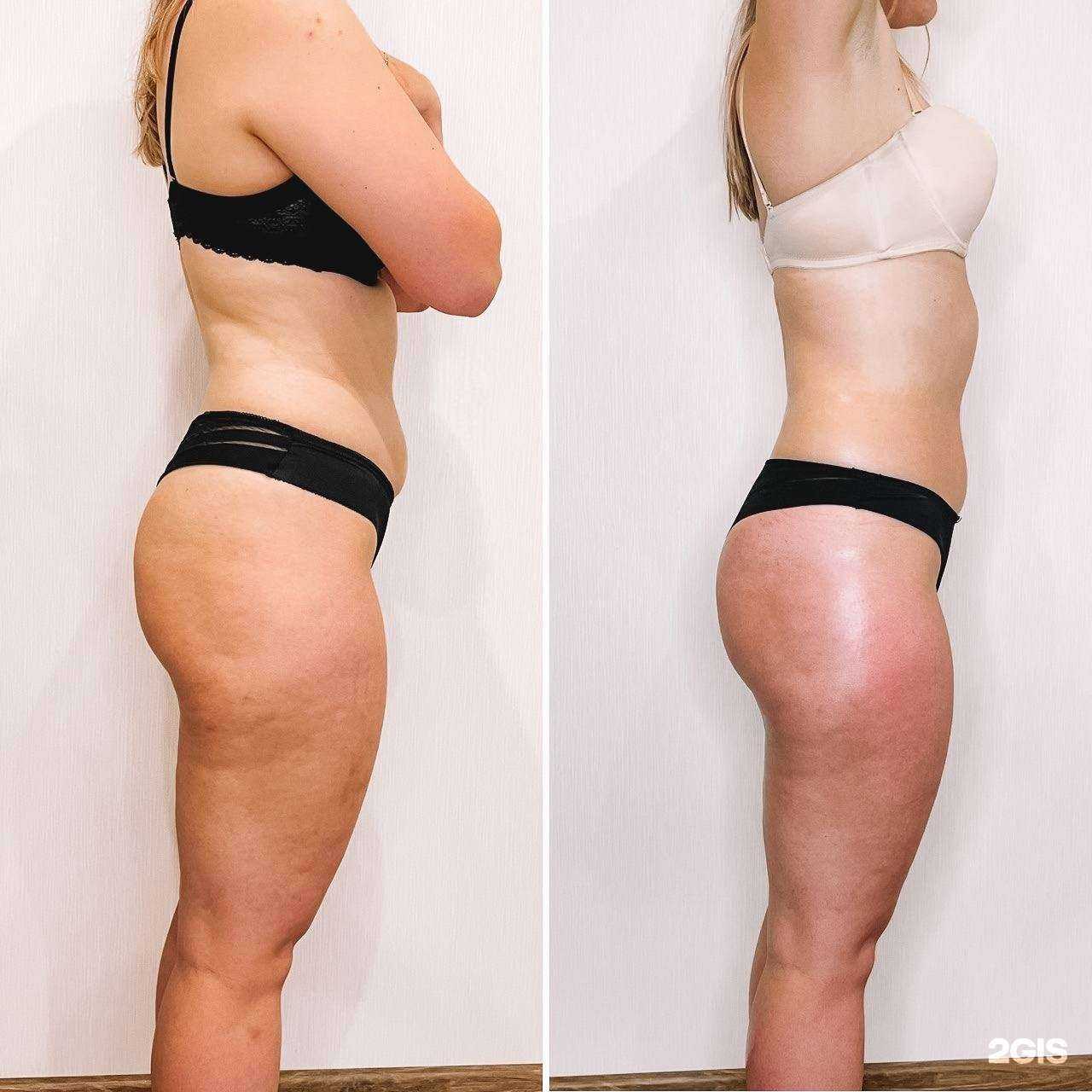 Отзывы на компанию LPG plastic в Екатеринбурге c фото