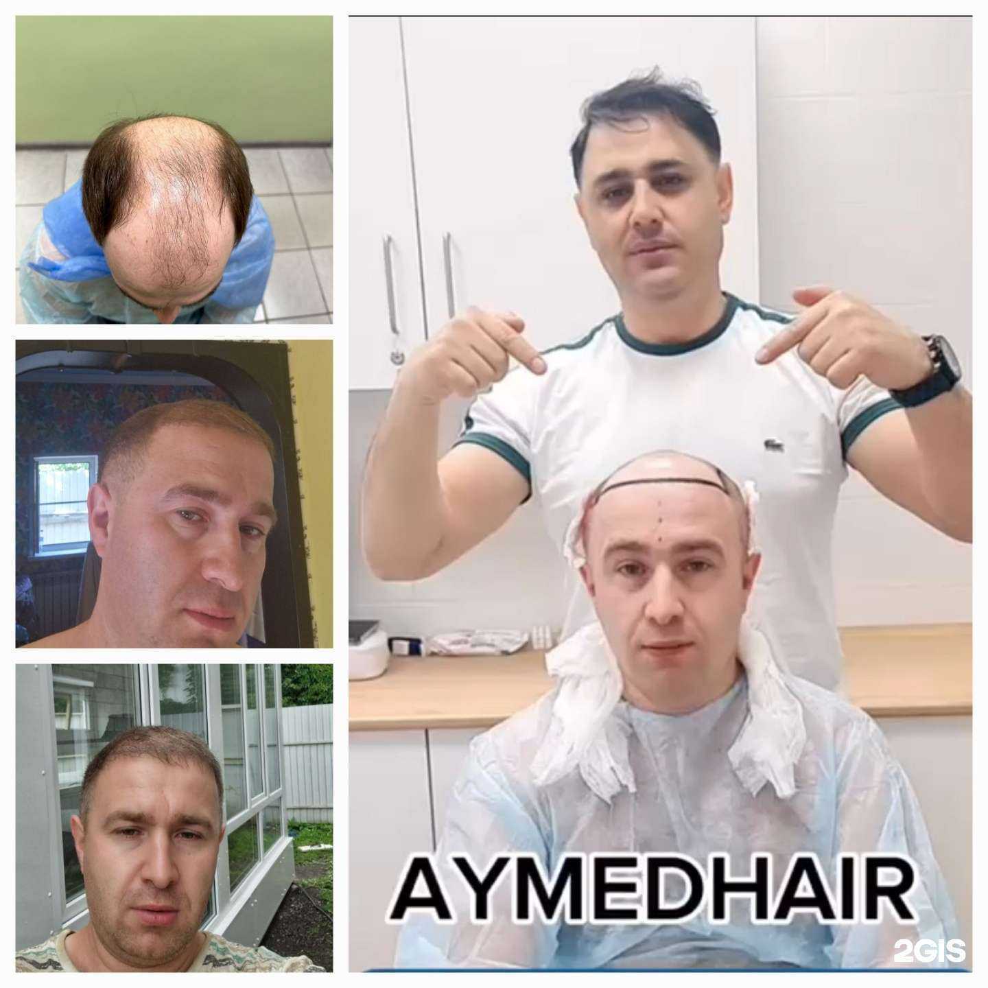 Отзывы на компанию Aymedhair в г. Уфа c фото