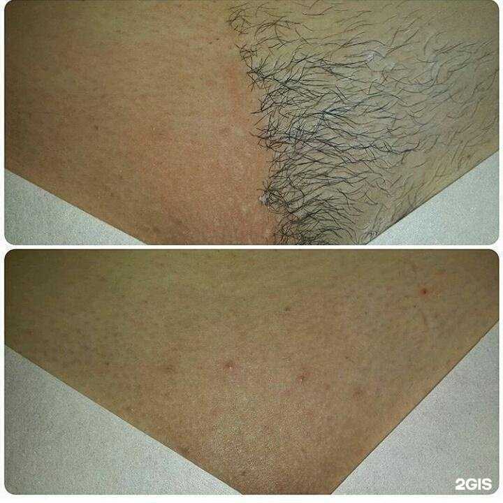 Отзывы на компанию Студия шугаринга в Новокузнецке c фото