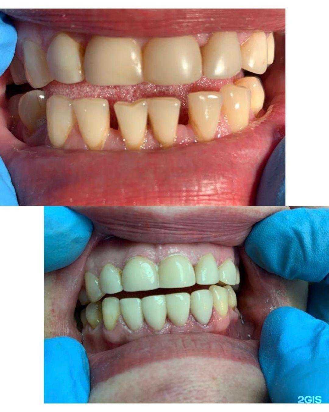 Отзывы на компанию Леодент в г. Новосибирск c фото