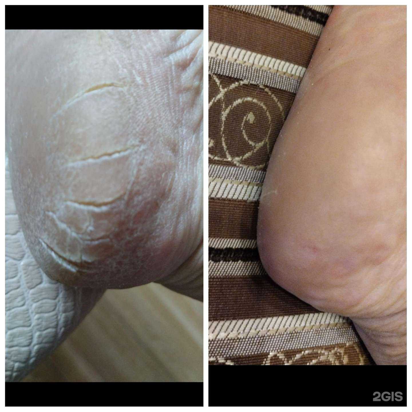 Отзывы на компанию Кабинет подолога Альбины Татарской в Казани c фото