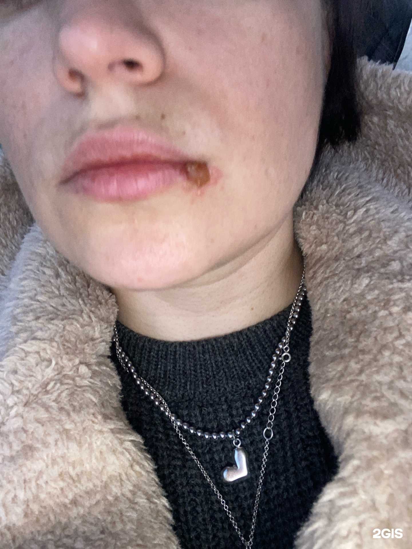 Отзывы на компанию ДентАС в г. Ярославль c фото