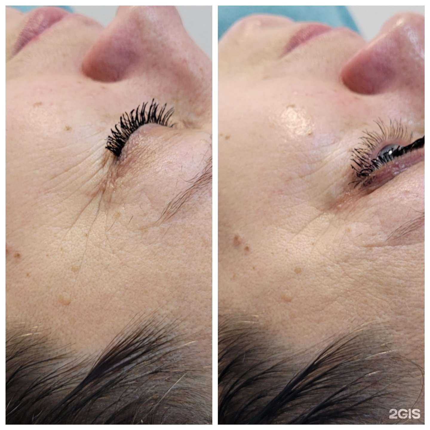 Отзывы на компанию Студия косметологии и эпиляции в Новосибирске c фото