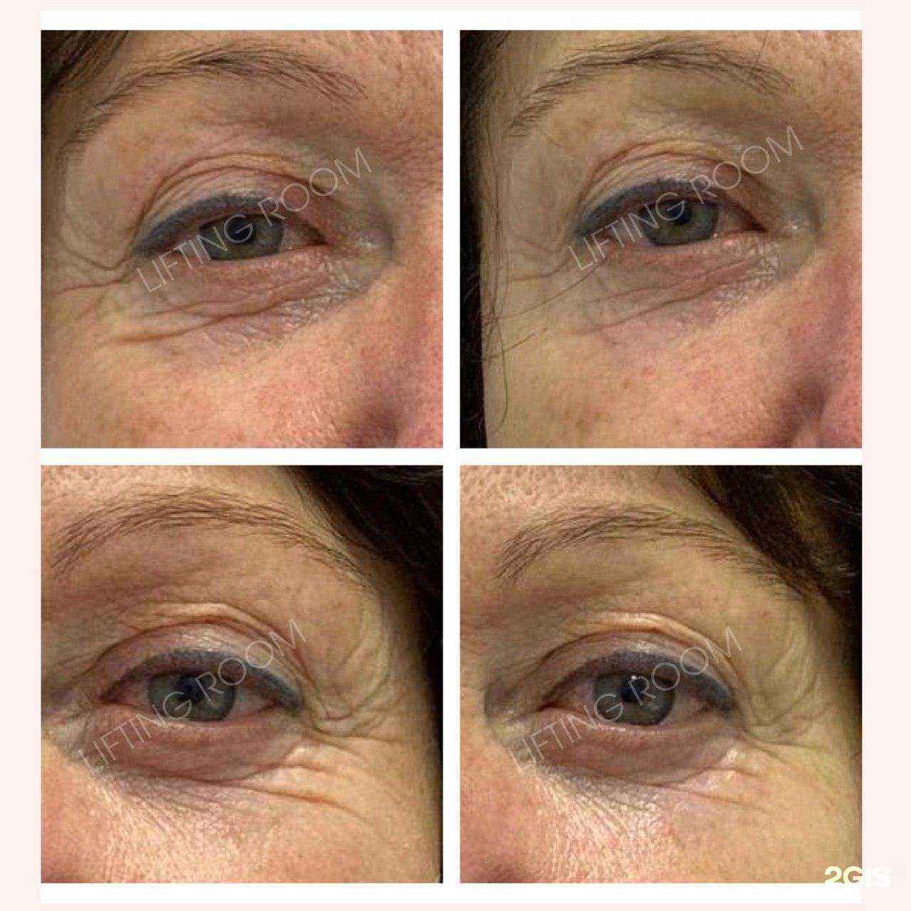 Отзывы на компанию Lifting Room в Краснодаре c фото