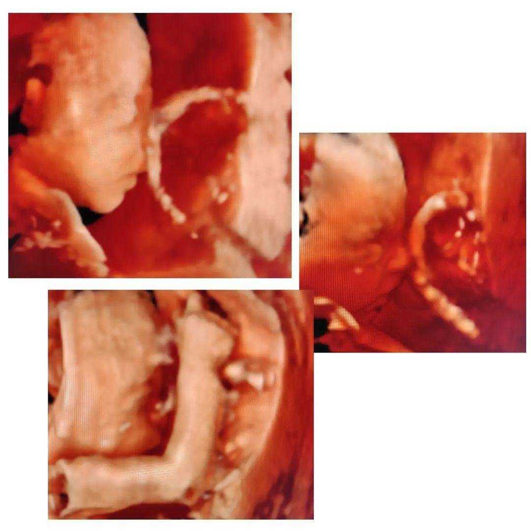 Отзывы на компанию UltraЗвук в г. Мариинск c фото