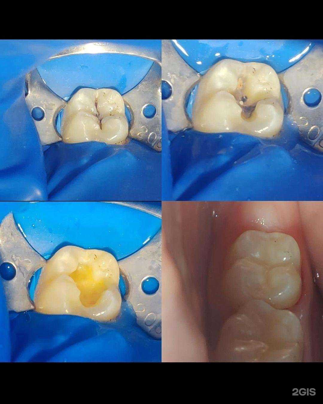 Отзывы на компанию Dent Berg в Махачкале c фото