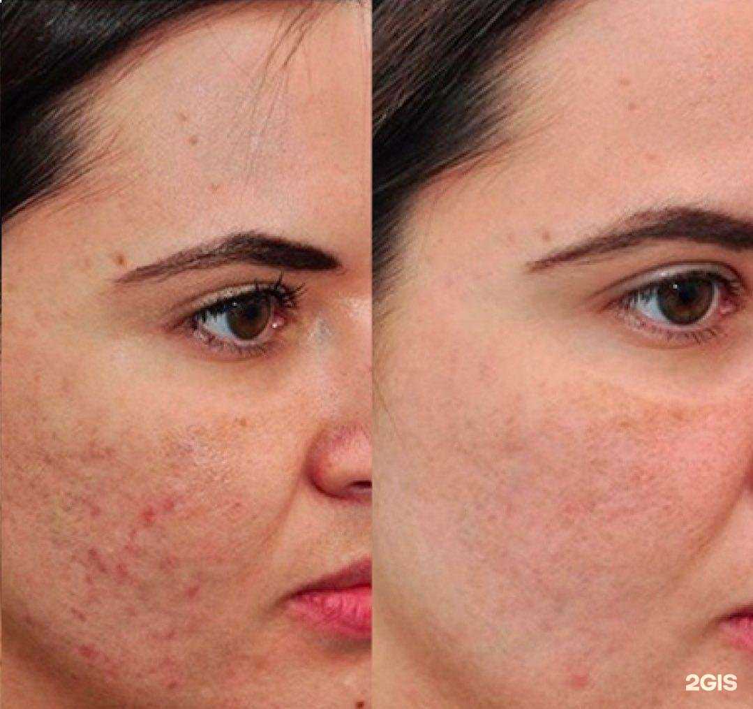 Отзывы на компанию White laser в г. Каспийск c фото