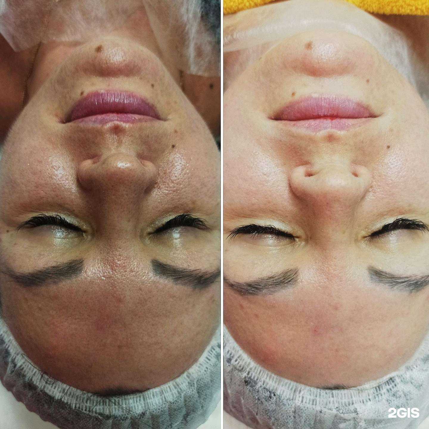 Отзывы на компанию Лицо и Тело в Саратове c фото