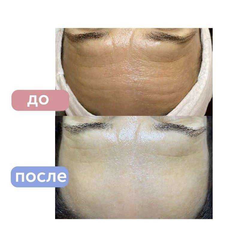 Отзывы на компанию Naturo-derm в Краснодаре c фото