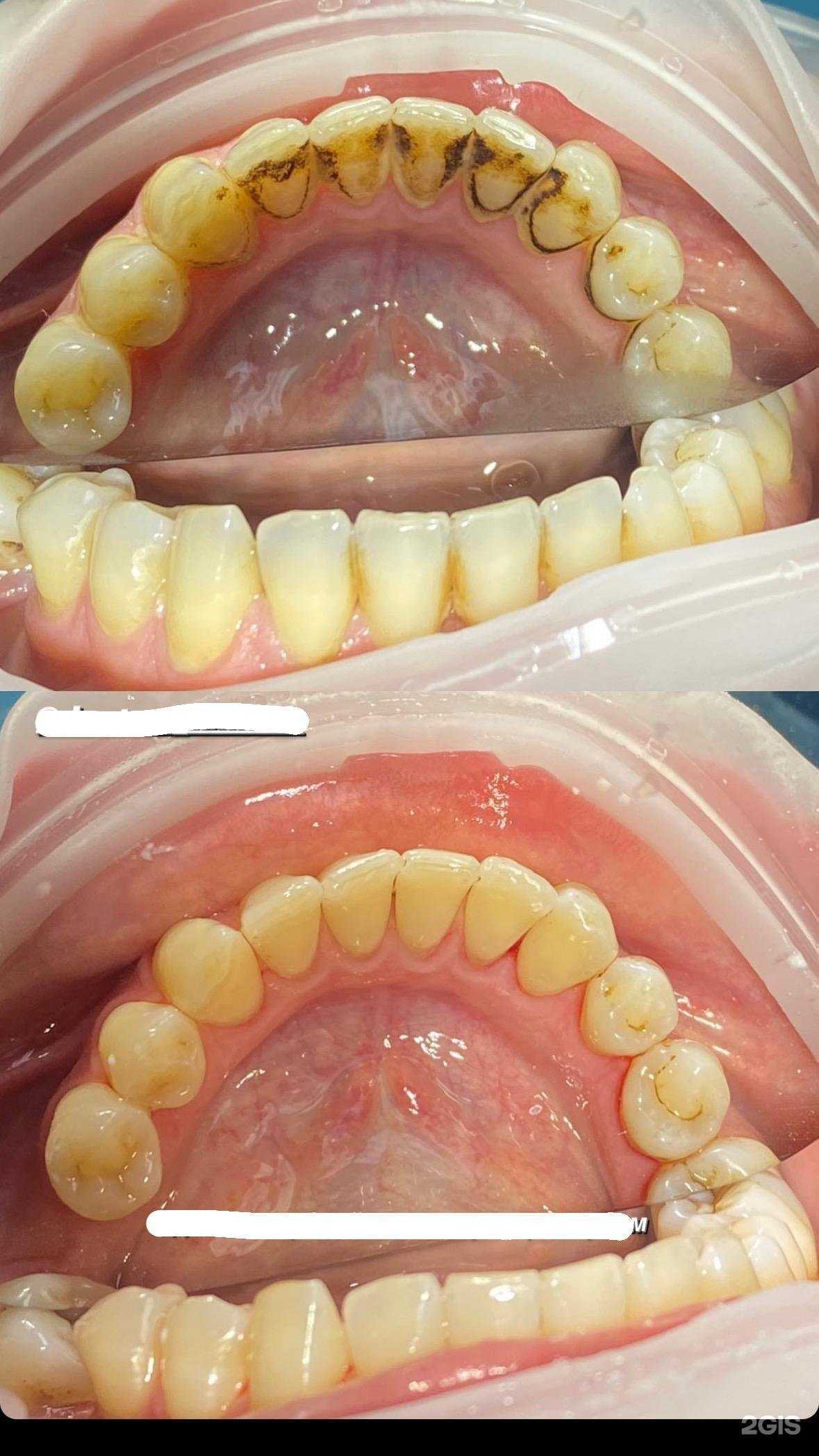 Отзывы на компанию Dent Art в г. Норильск c фото