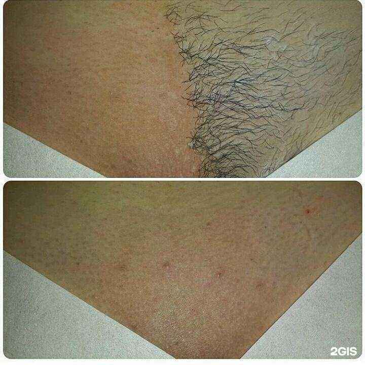 Отзывы на компанию Студия шугаринга в г. Новокузнецк c фото