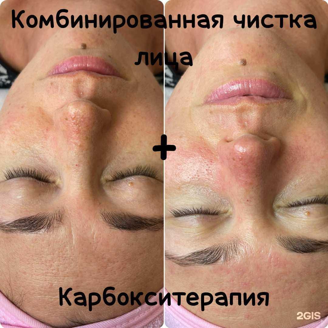 Отзывы на компанию Кабинет массажа и уходовых процедур за лицом в Владивостоке c фото