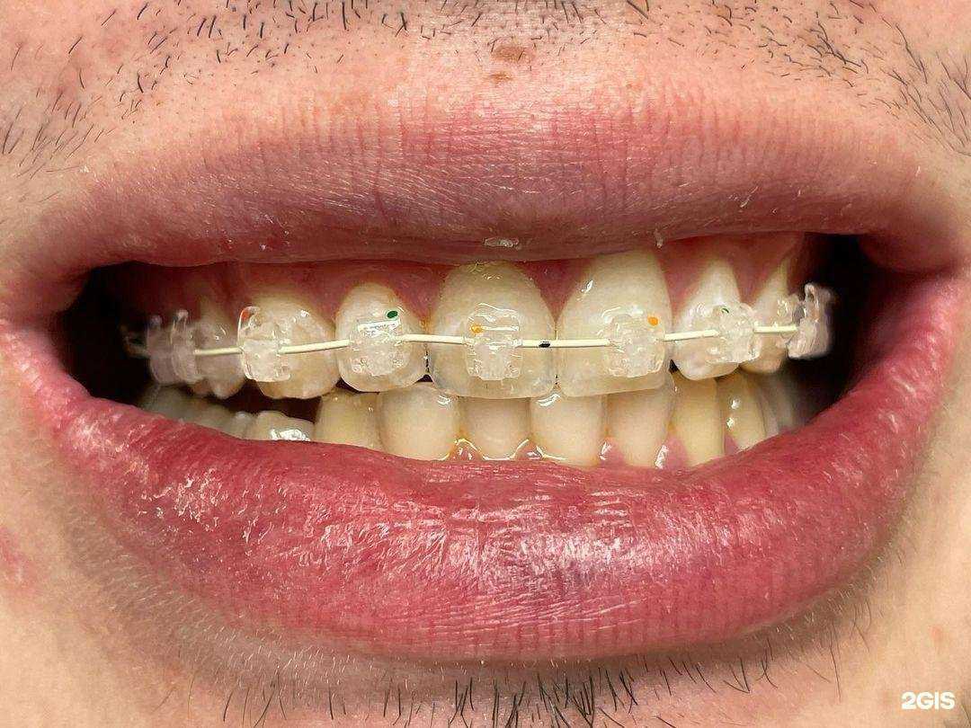 Отзывы на компанию Арз-дент в г. Краснодар c фото