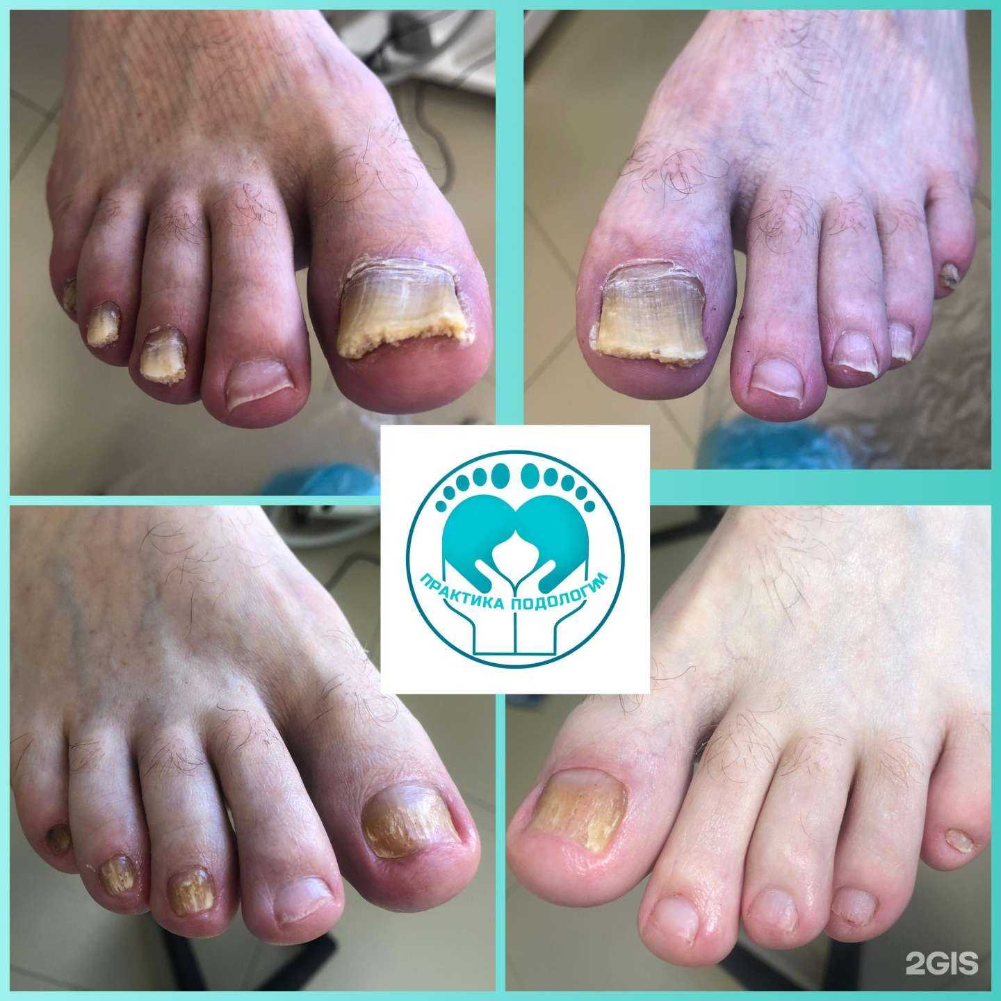 Отзывы на компанию Практика подологии в Перми c фото