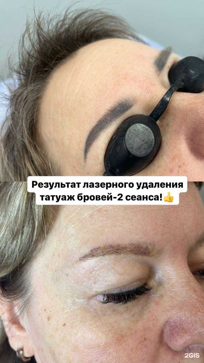 Отзывы на компанию Cтудия косметологии в Самаре c фото