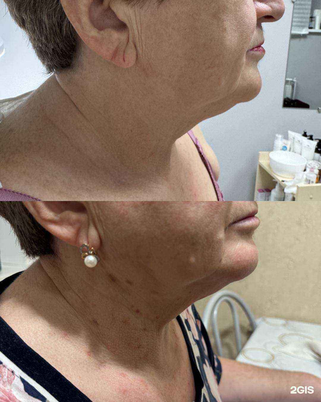 Отзывы на компанию Alinel  в Казани c фото