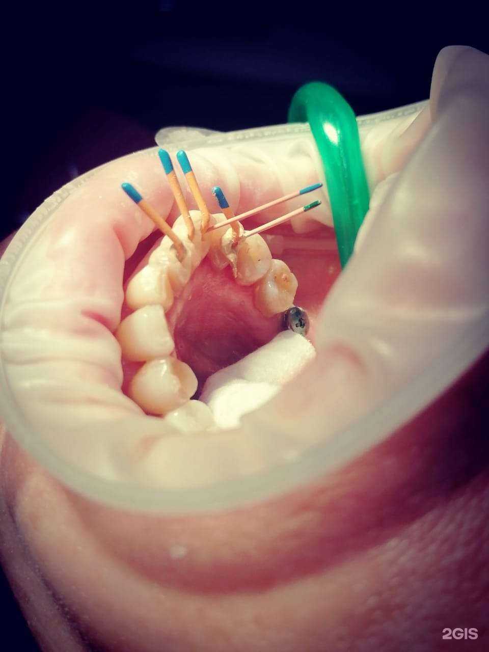Отзывы на компанию Дантист S в Ростове-на-Дону c фото