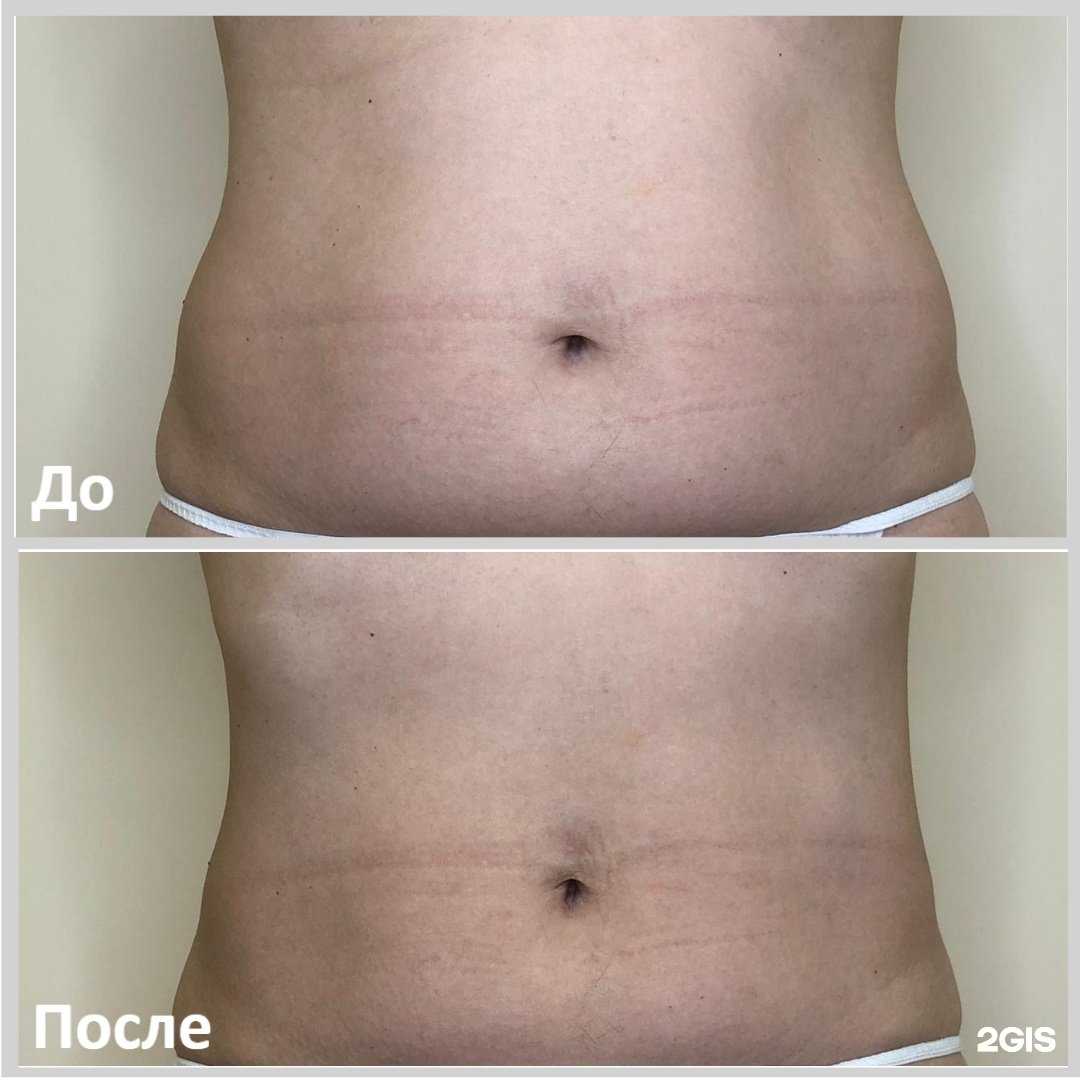 Отзывы на компанию Пространство красоты в Находке c фото