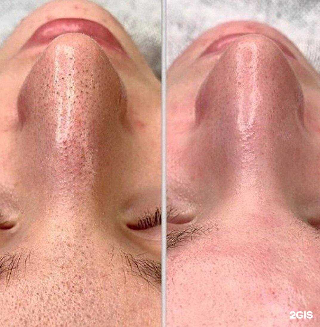 Отзывы на компанию Кабинет депиляции в г. Тольятти c фото