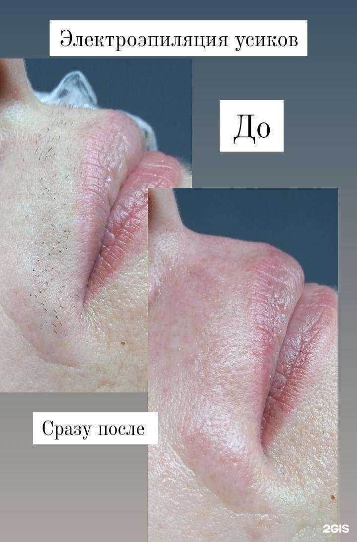 Отзывы на компанию Smooth skin в г. Омск c фото