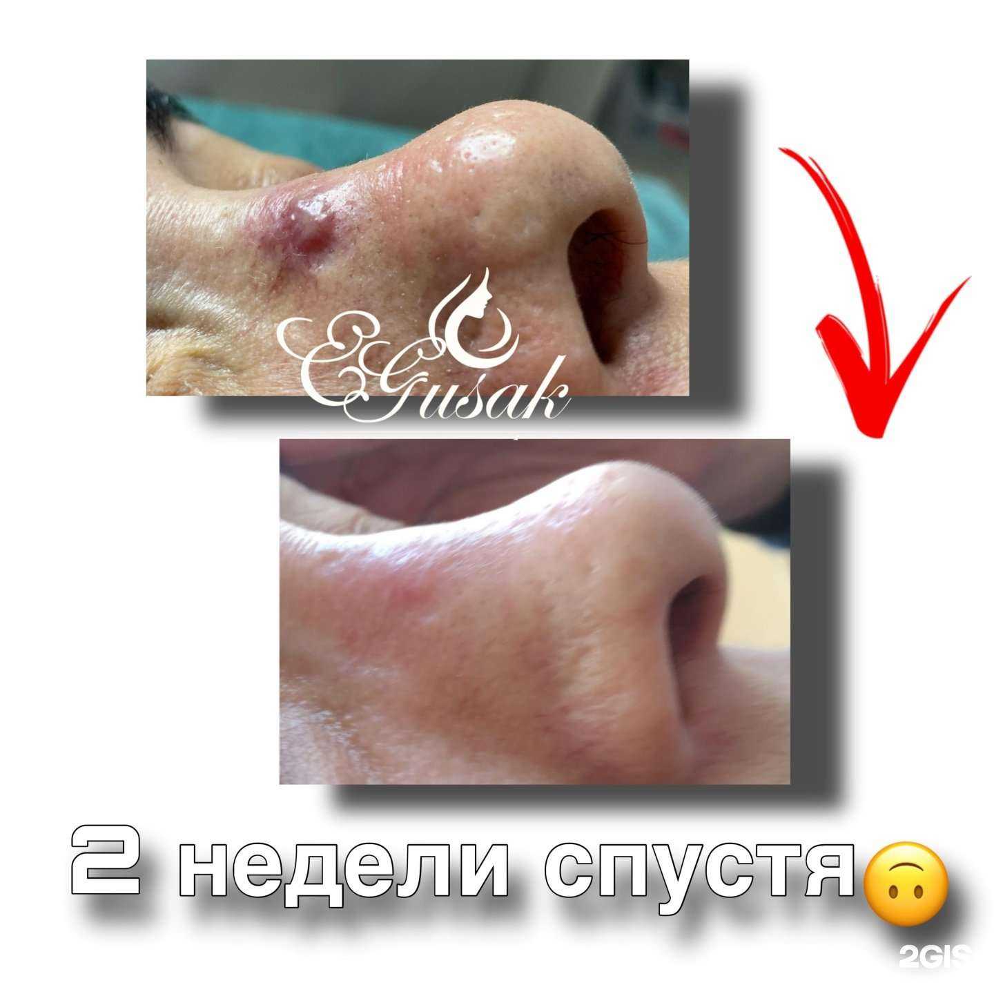 Отзывы на компанию Худею и Точка в г. Тюмень c фото