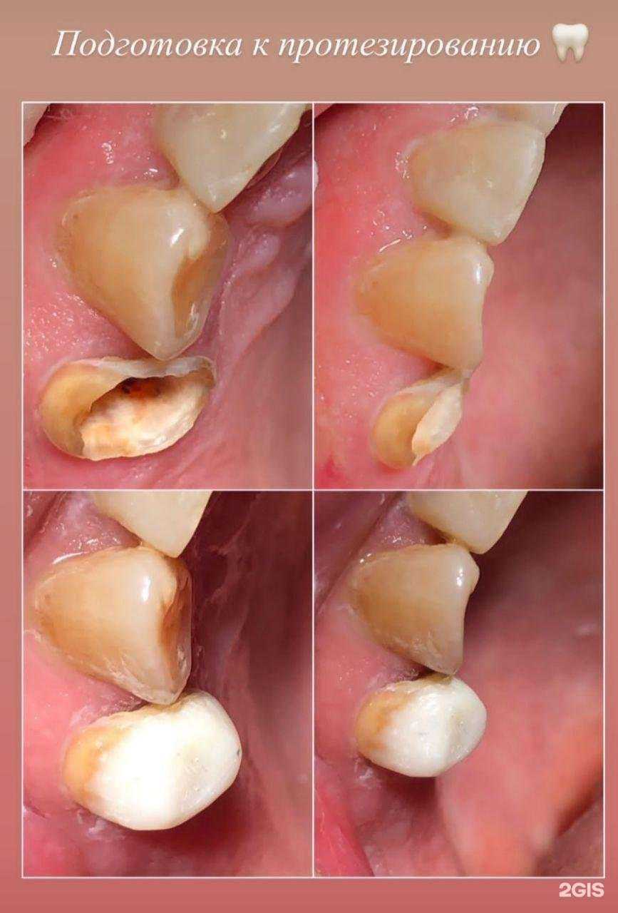 Отзывы на компанию Зубной лекарь в г. Анапа c фото