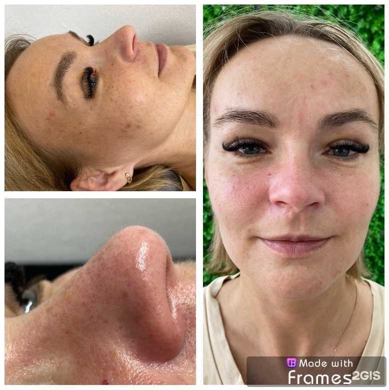 Отзывы на компанию Студия перманентного макияжа и эстетической косметологии в г. Псков c фото
