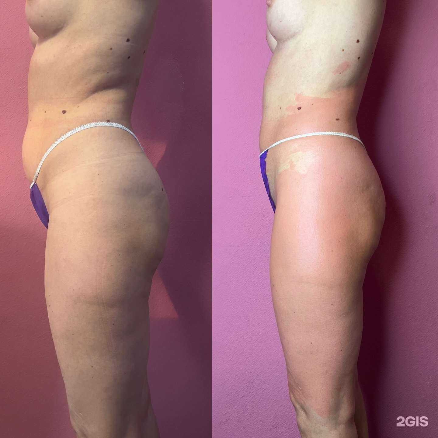 Отзывы на компанию body_massage_vl в Владивостоке c фото