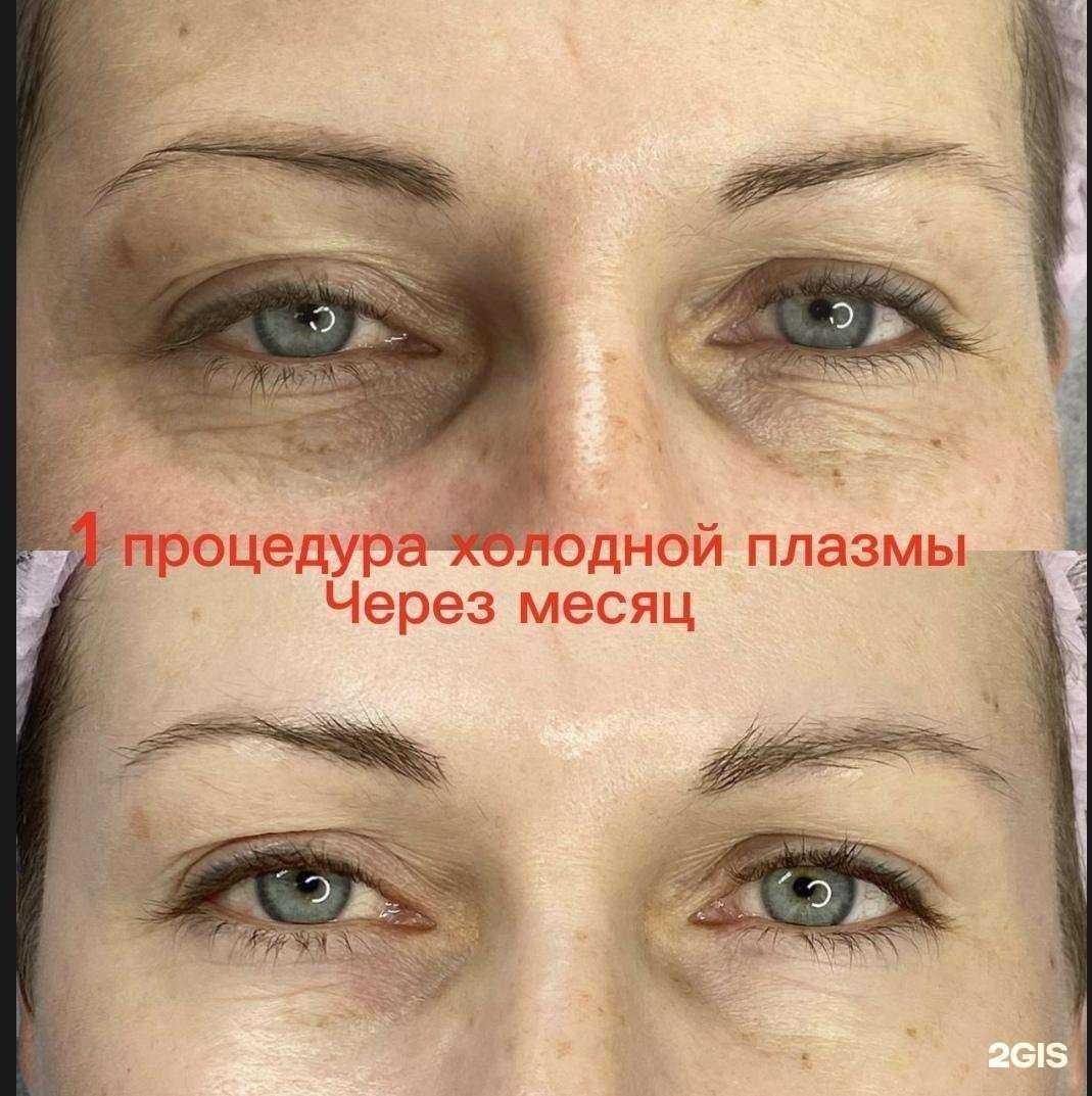 Отзывы на компанию Студия холодной плазмы в г. Иркутск c фото