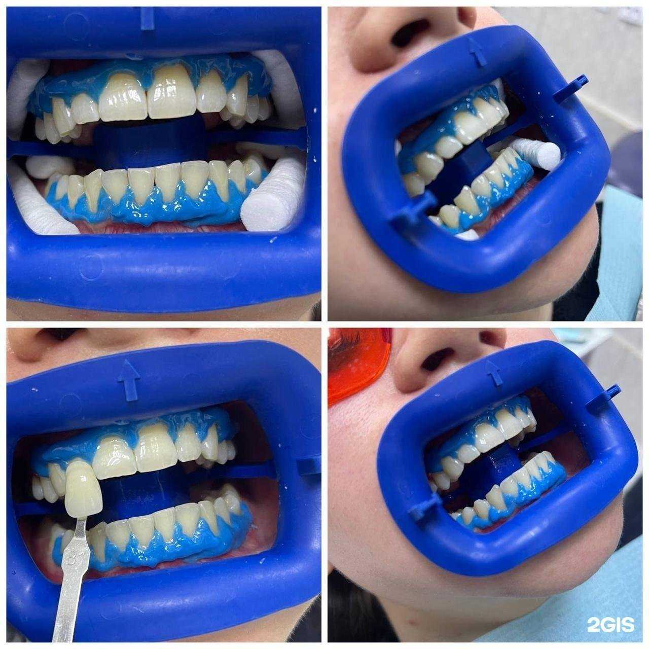 Отзывы на компанию Альфа-дент в г. Петрозаводск c фото