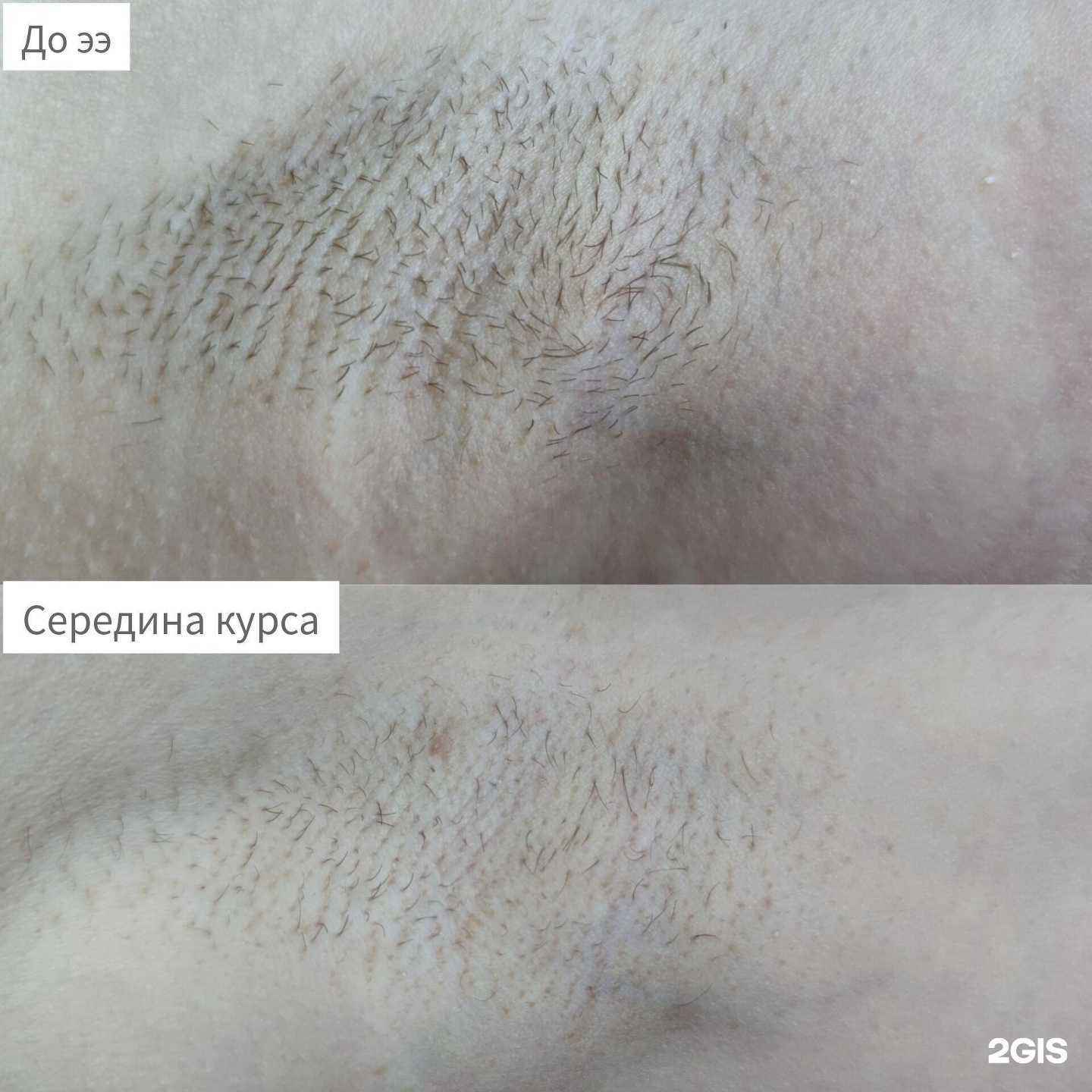 Отзывы на компанию Студия эпиляции в Ставрополе c фото