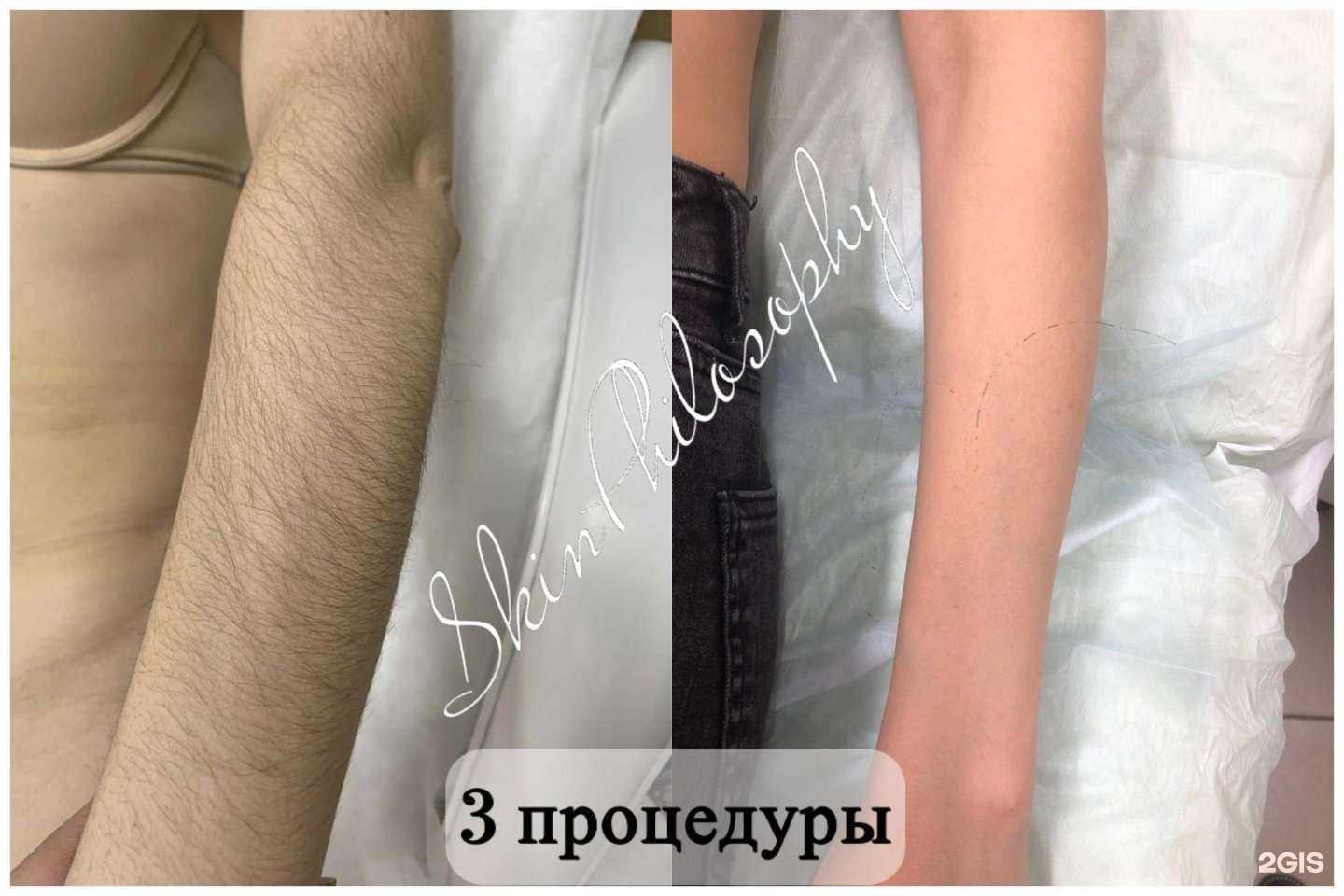 Отзывы на компанию Skin Philosophy в г. Уфа c фото