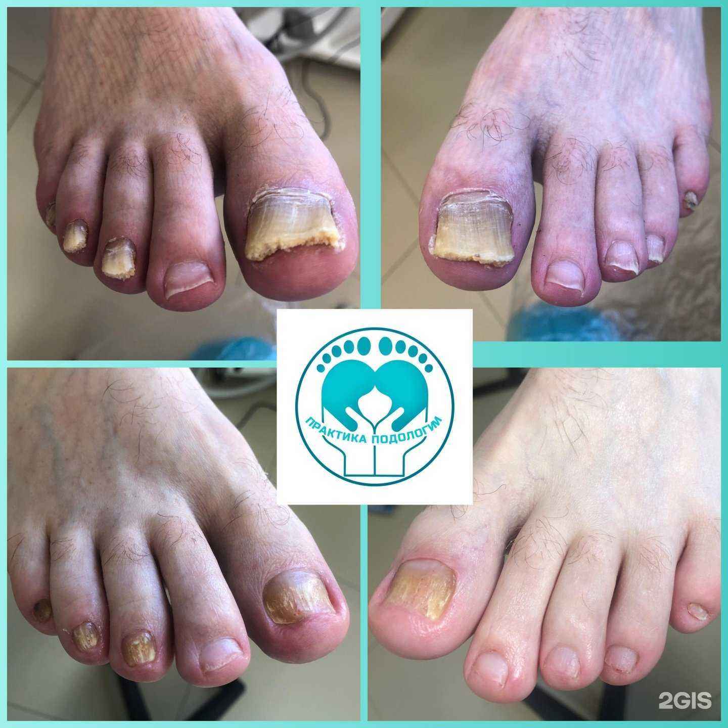 Отзывы на компанию Практика подологии в г. Пермь c фото