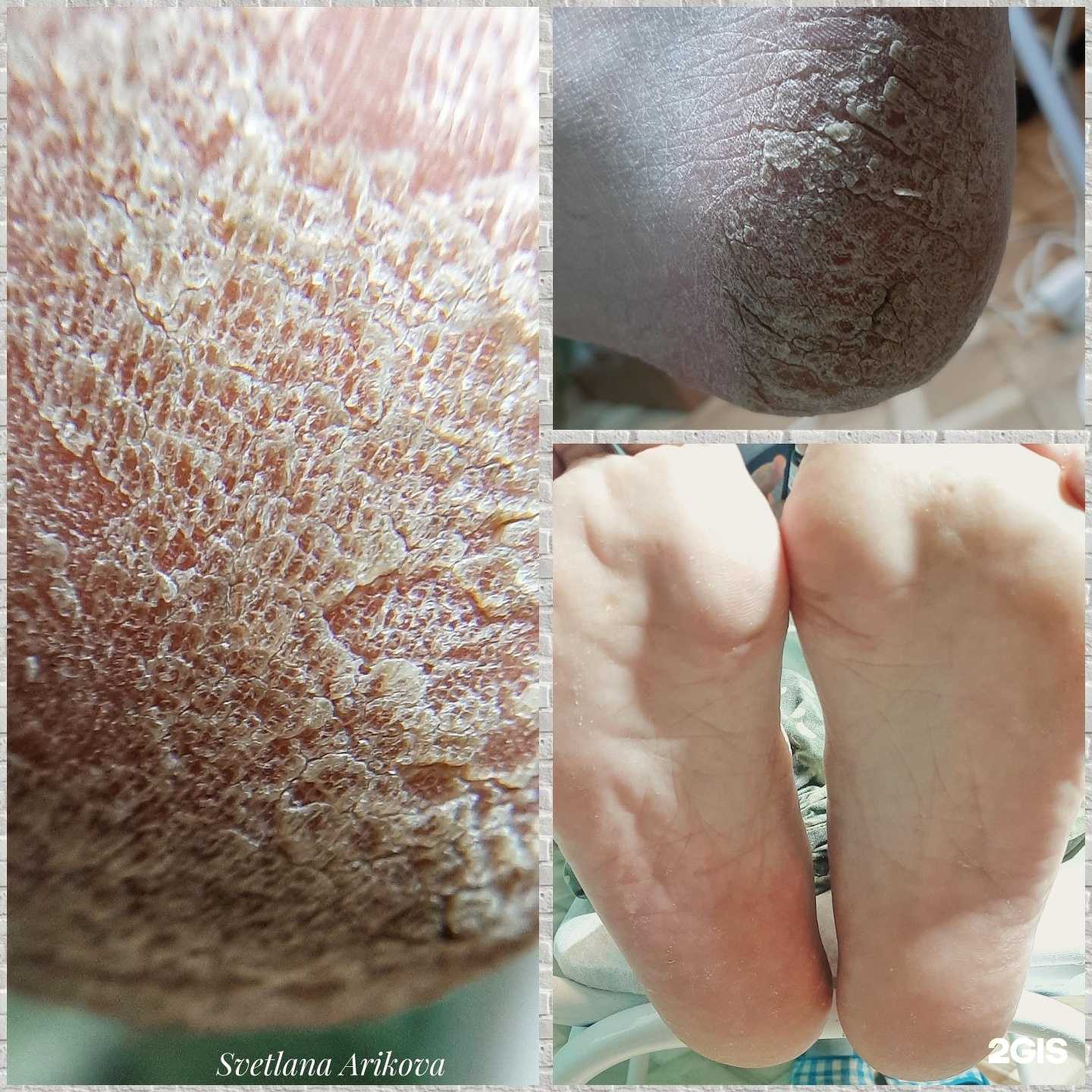 Отзывы на компанию Кабинет подологии и эстетики в г. Воронеж c фото