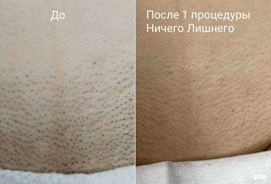 Отзывы на компанию Ничего лишнего в Твери c фото