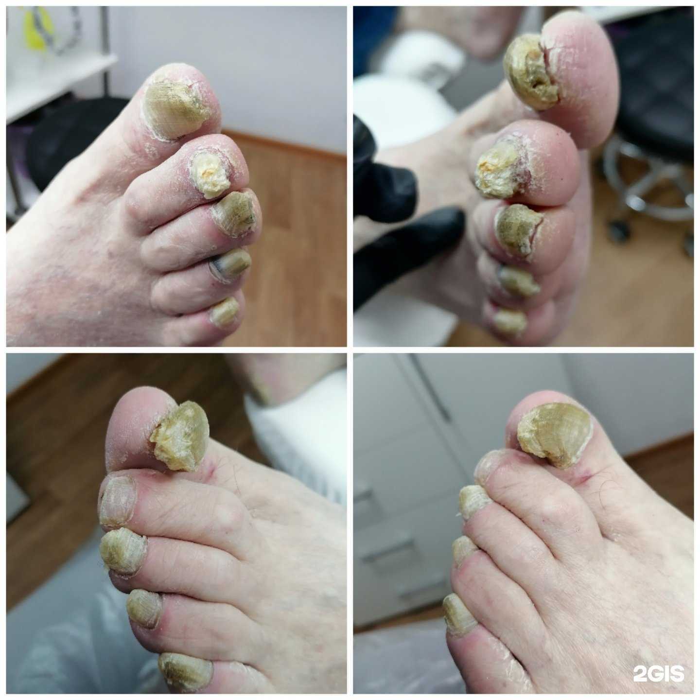 Отзывы на компанию Кабинет подологии и эстетики ногтей Татьяны Асаблиной в г. Находка c фото