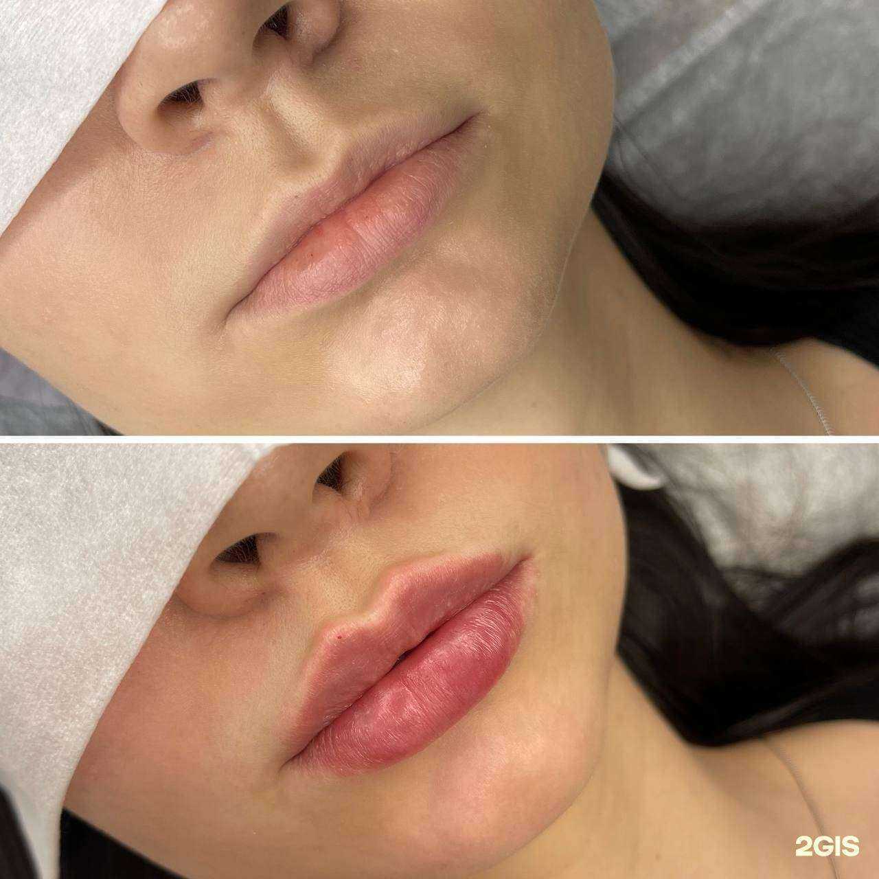 Отзывы на компанию Evva esthetic в г. Тверь c фото