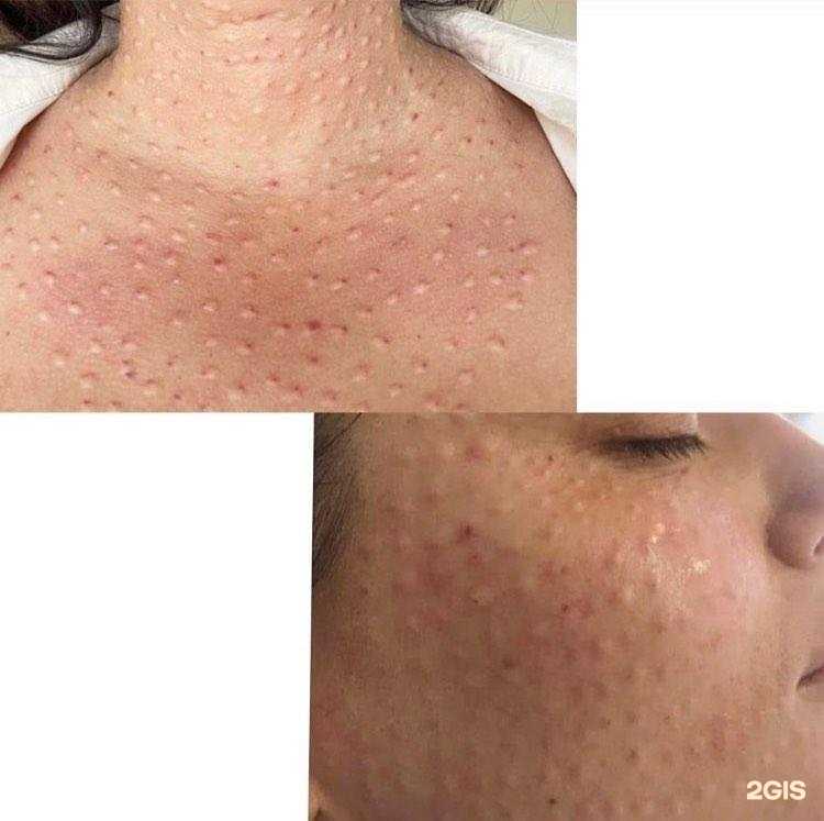 Отзывы на компанию Косметология Доктора Петуховой в Ростове-на-Дону c фото