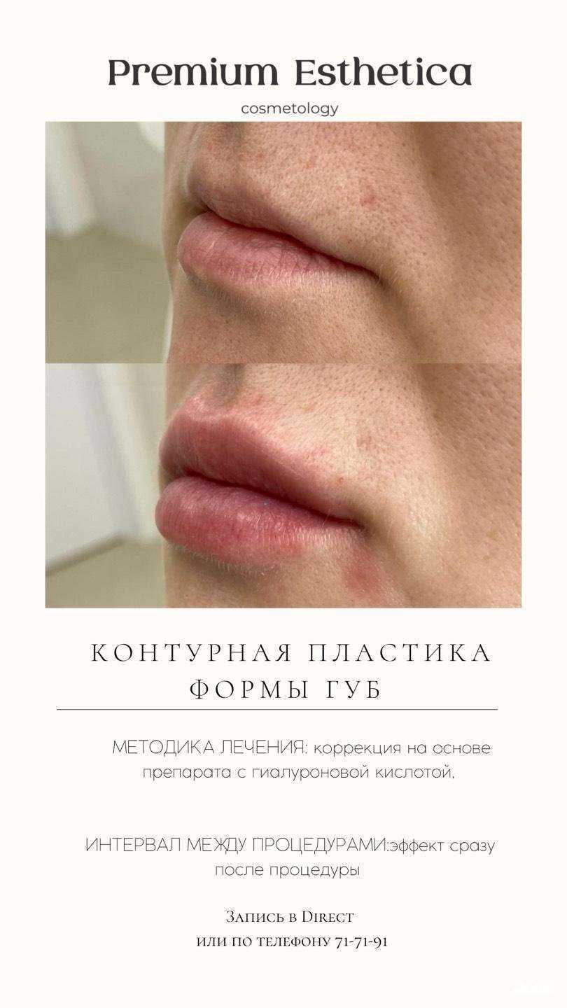 Отзывы на компанию Premium Esthetica Cosmetology в Ульяновске c фото