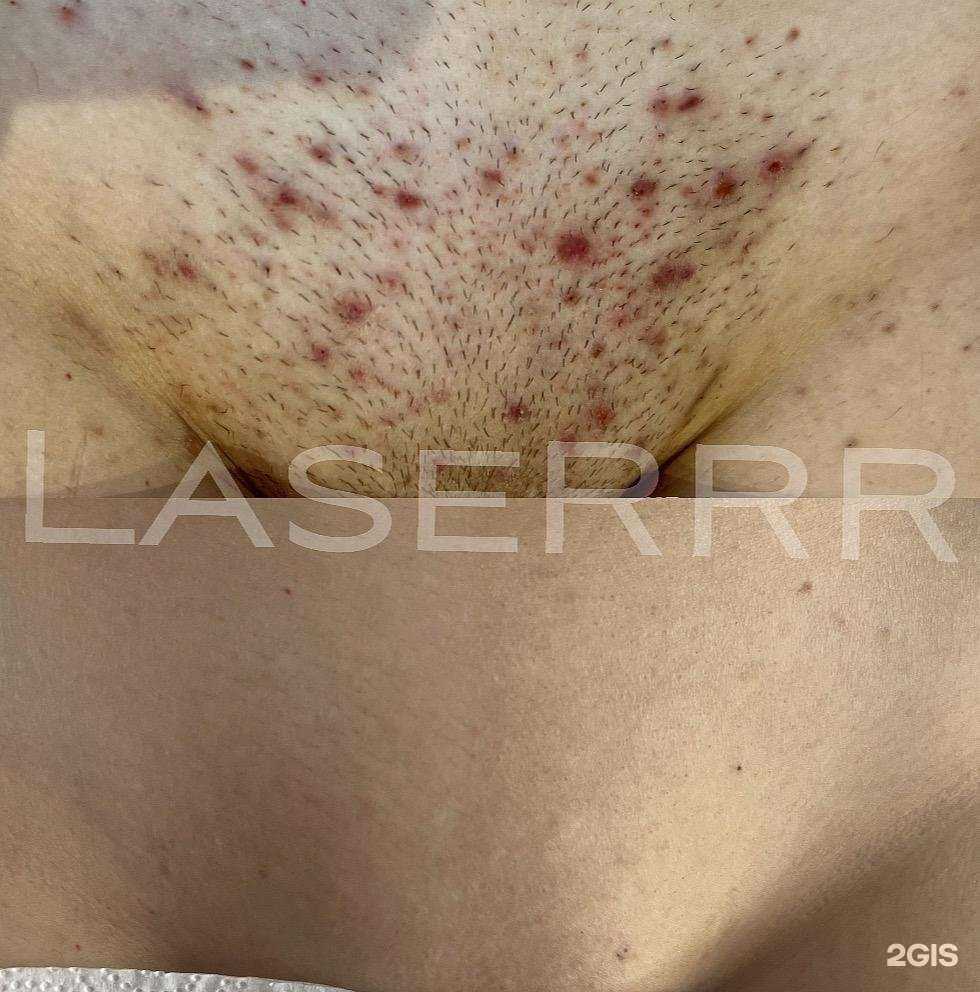 Отзывы на компанию Laserrr в Новосибирске c фото