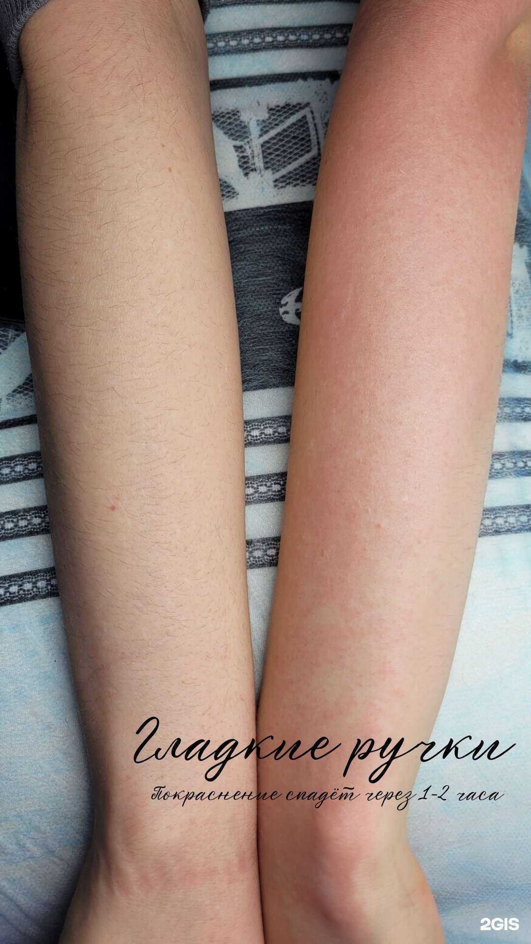 Отзывы на компанию Кабинет электроэпиляции в г. Энгельс c фото