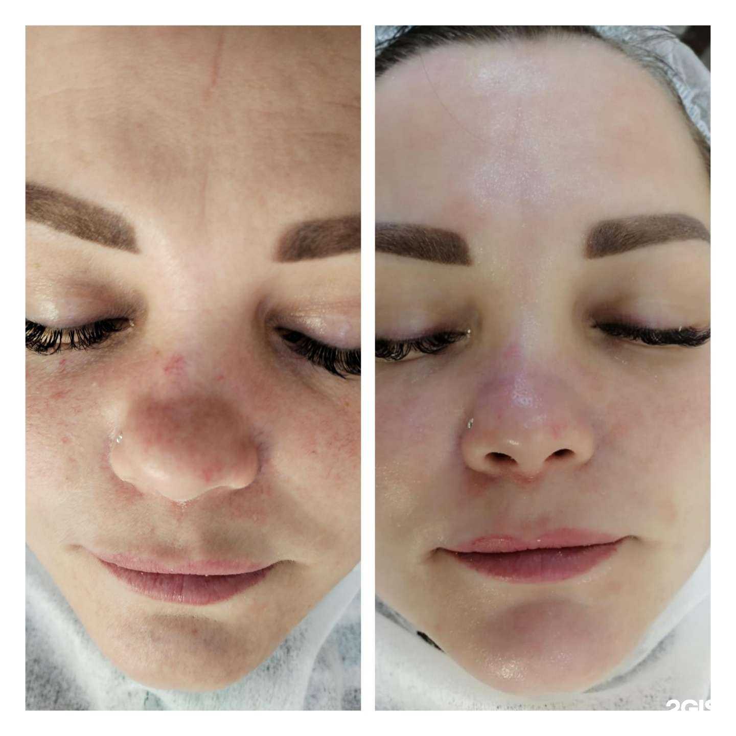 Отзывы на компанию Резеда в Казани c фото