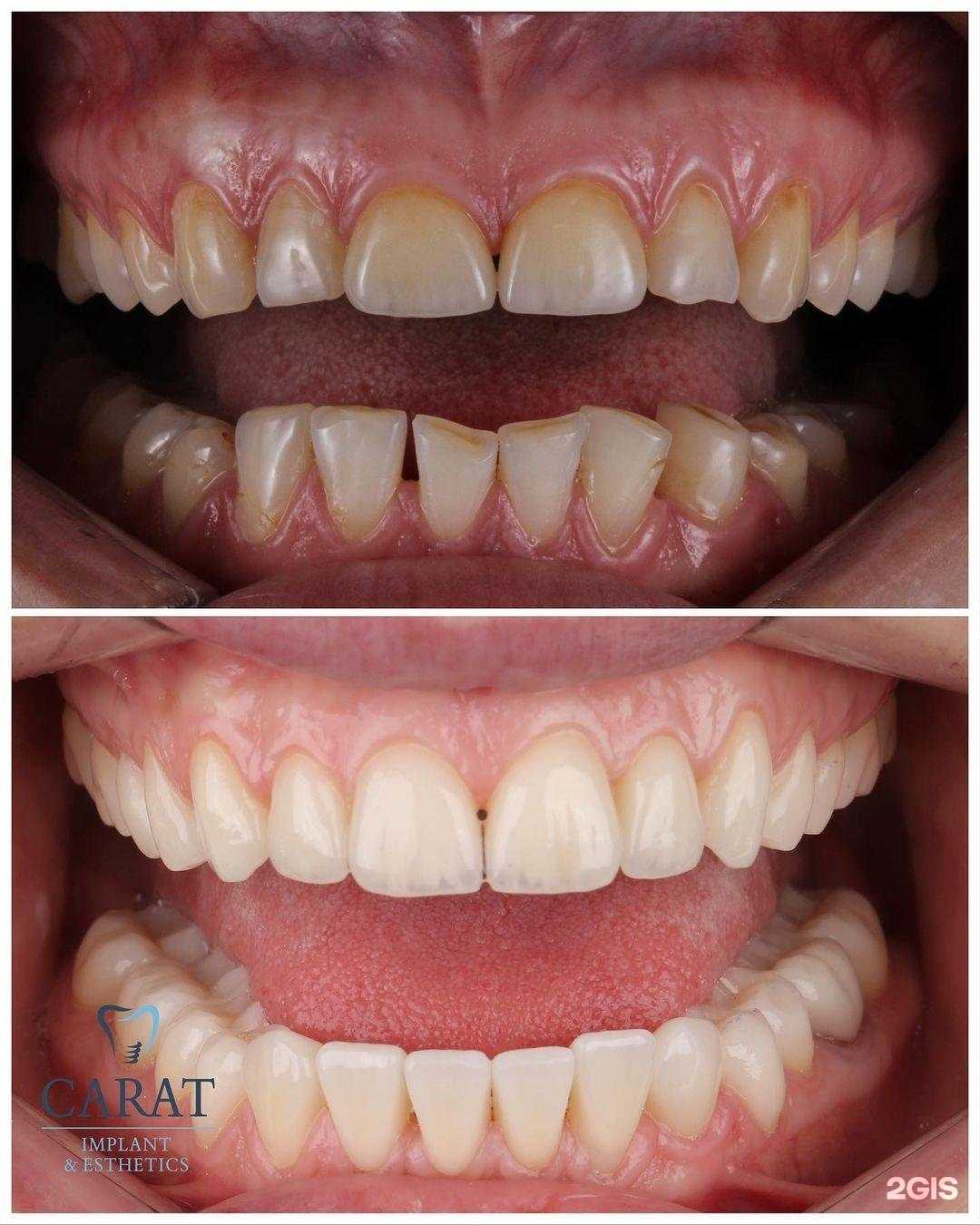 Отзывы на компанию Carat Dental Clinic в г. Дербент c фото